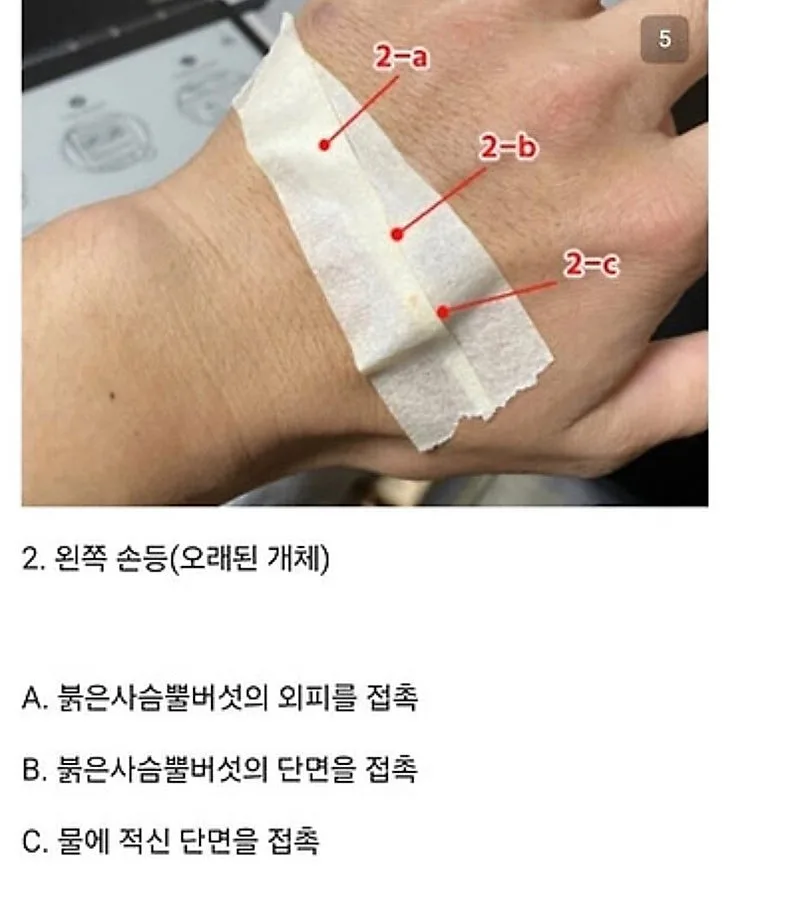 붉은사슴뿔버섯을 본인 몸에 실험한 일본인