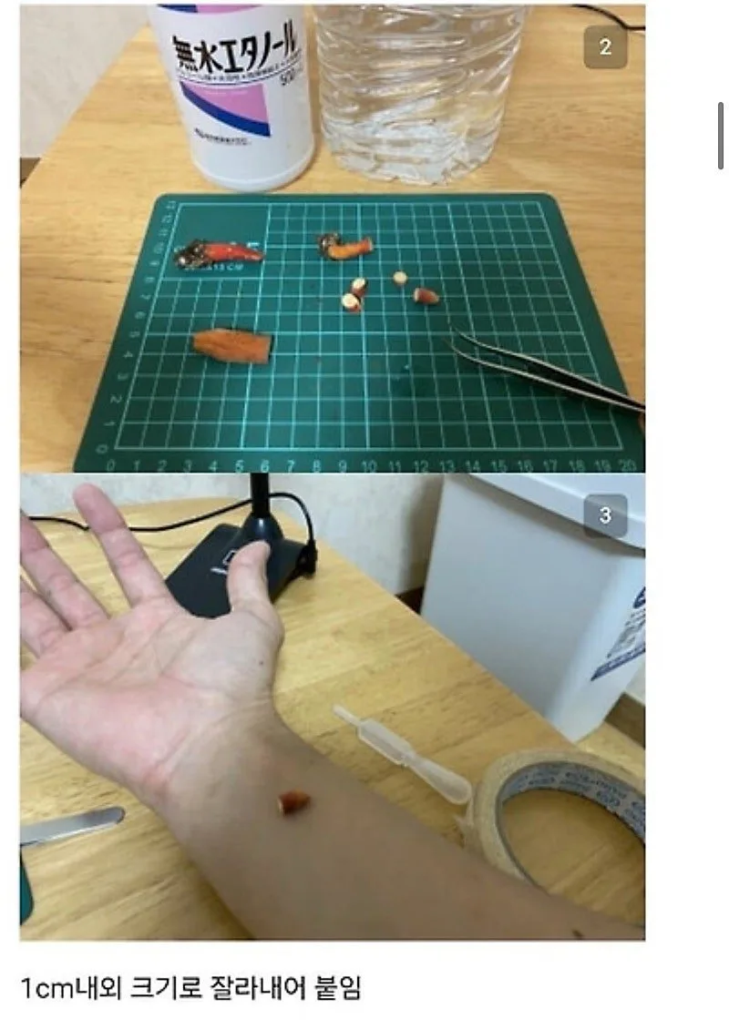붉은사슴뿔버섯을 본인 몸에 실험한 일본인