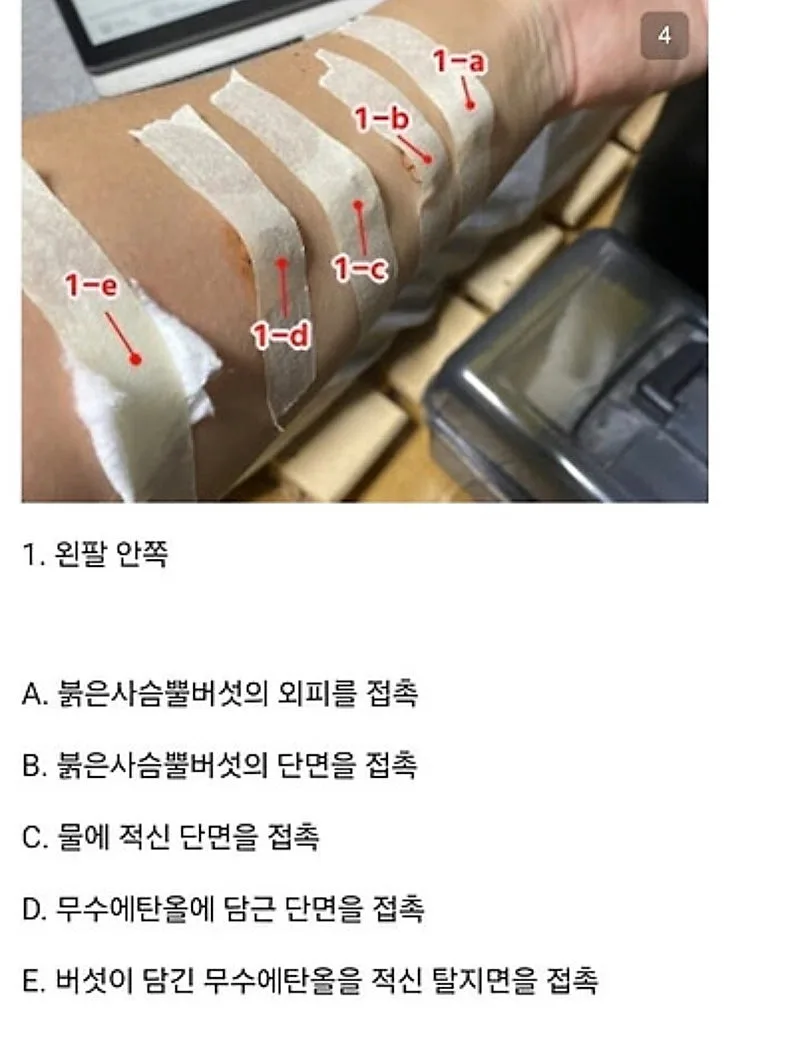 붉은사슴뿔버섯을 본인 몸에 실험한 일본인