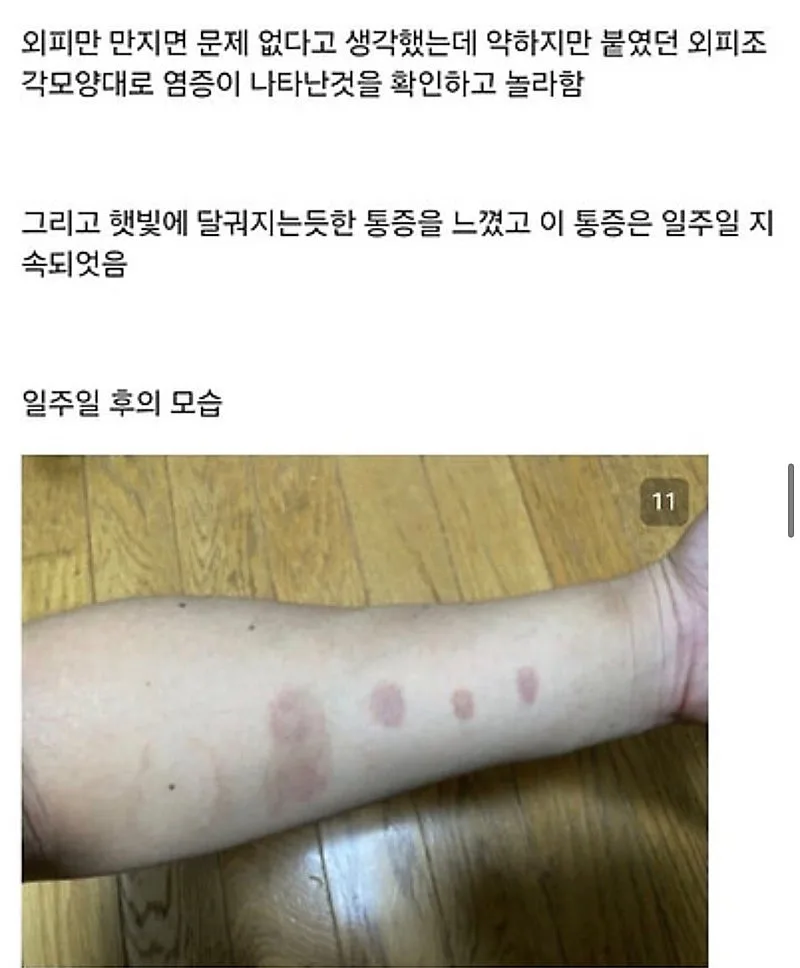 붉은사슴뿔버섯을 본인 몸에 실험한 일본인