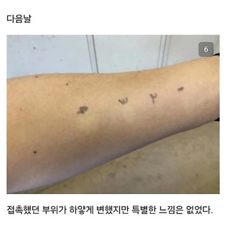 붉은사슴뿔버섯을 본인 몸에 실험한 일본인