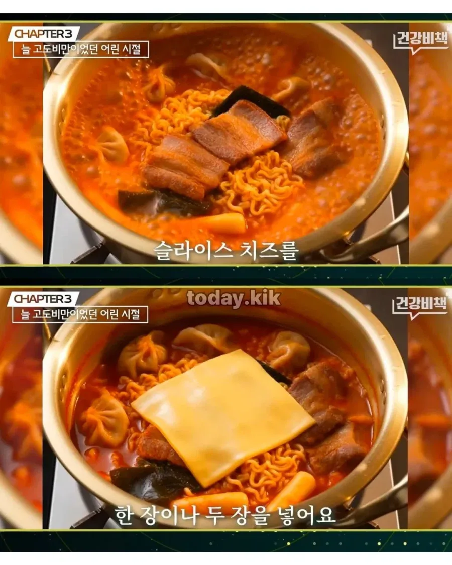 과거 고도비만 의사가 고딩 때 먹은 라면 레시피