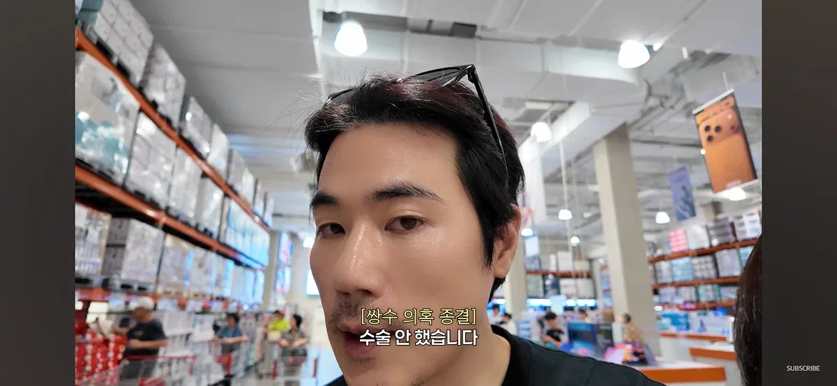 김강우 쌍수설 해명(?)