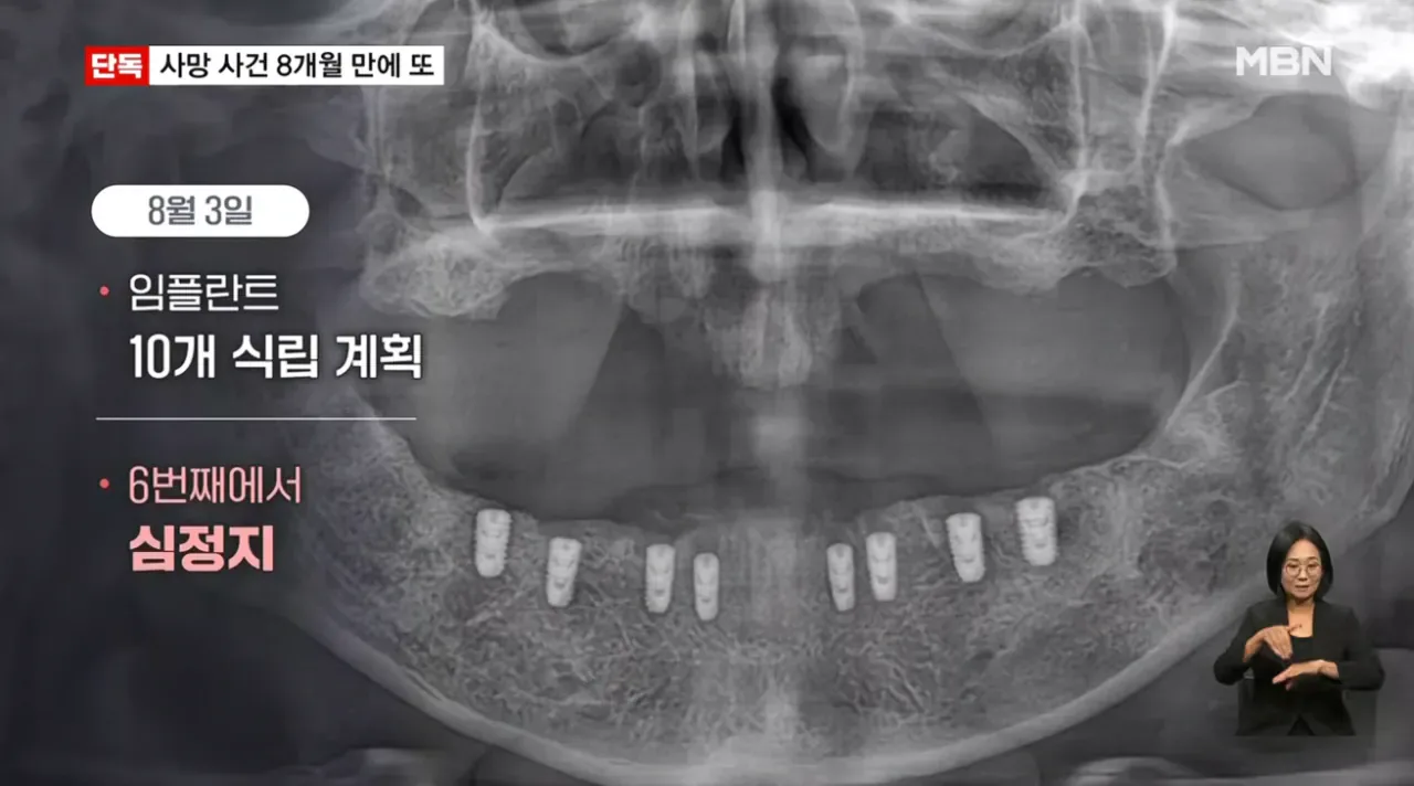 [단독] 강남 같은 치과서 8개월 새 2명 사망…그런 일 없어요 발뺌