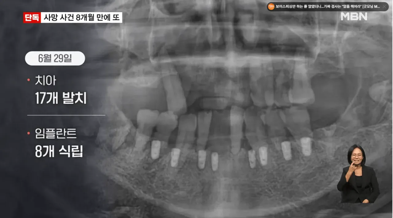 [단독] 강남 같은 치과서 8개월 새 2명 사망…그런 일 없어요 발뺌