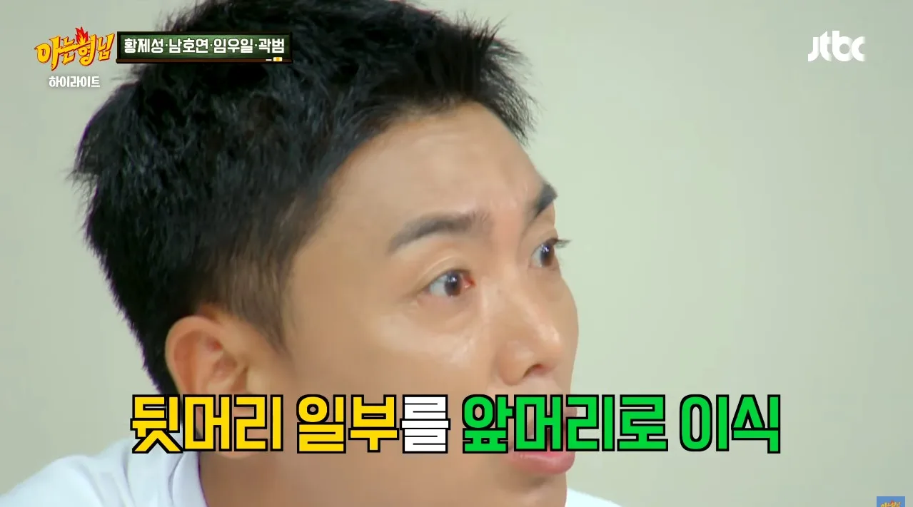살이 찐 곽범에게 친한 작가가 방송 안 할 거냐고, 살이 쪄서 방송에서 쓰기 좀 그렇다고 한 말에 여러 시술을 하게 되었고 그러다 보니 중독이 되어서 수천 썼다고 함