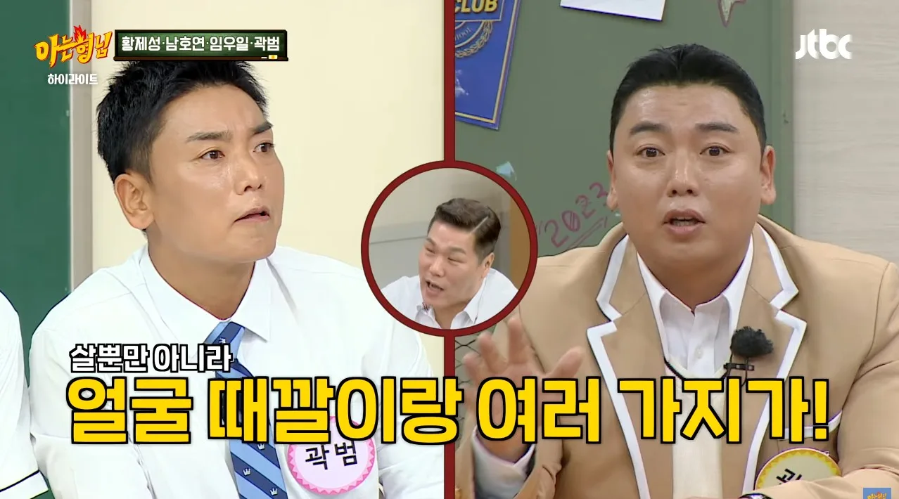 살이 찐 곽범에게 친한 작가가 방송 안 할 거냐고, 살이 쪄서 방송에서 쓰기 좀 그렇다고 한 말에 여러 시술을 하게 되었고 그러다 보니 중독이 되어서 수천 썼다고 함