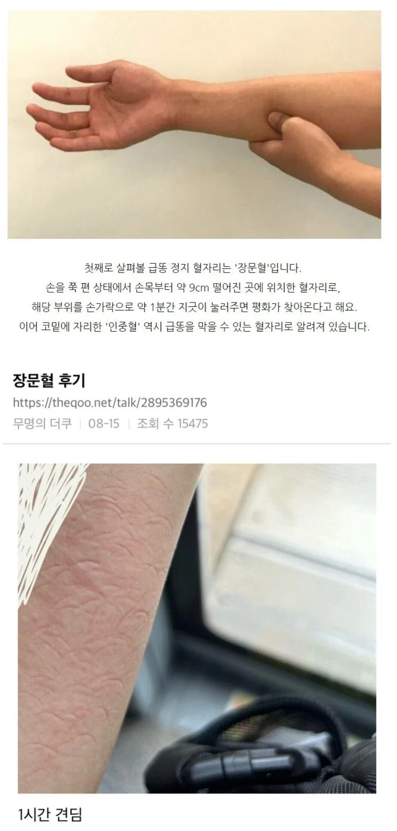 장문혈 후기.jpg