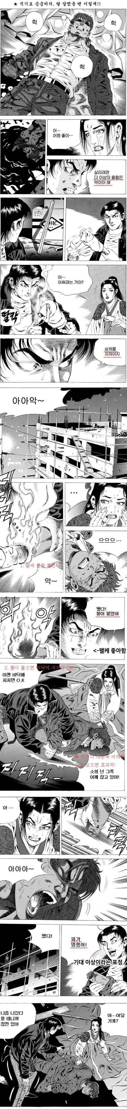 김성모식 상처 치료 방법.JPG