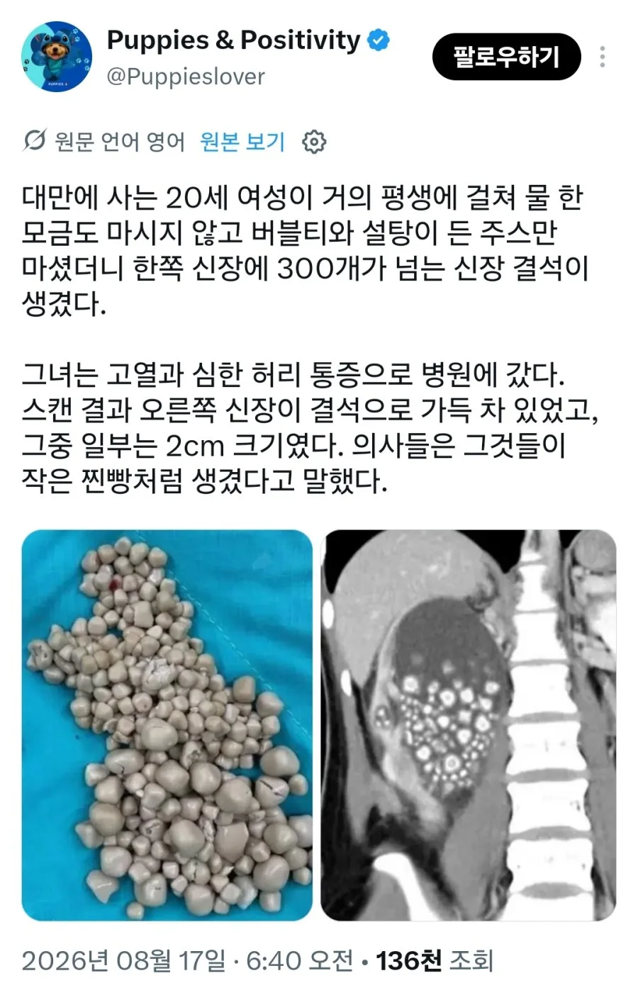 물 안마시고 살면 위험한 이유.jpg