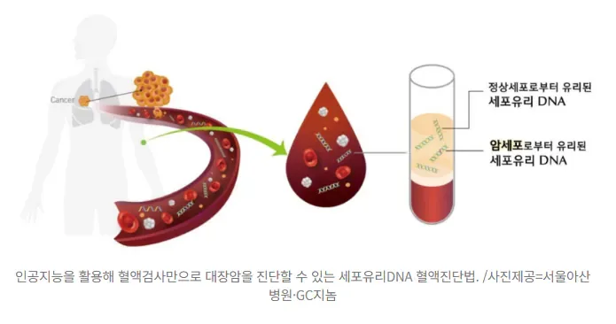 대장암 10명 중 9명 잡아냈다...내시경 없이 '피 한 번' 뽑으면 끝