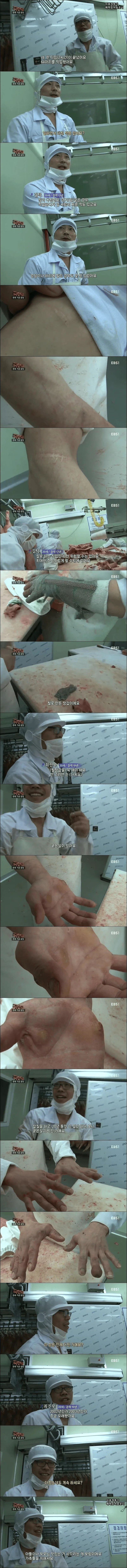 돼지 발골 19년차의 손상태.jpg