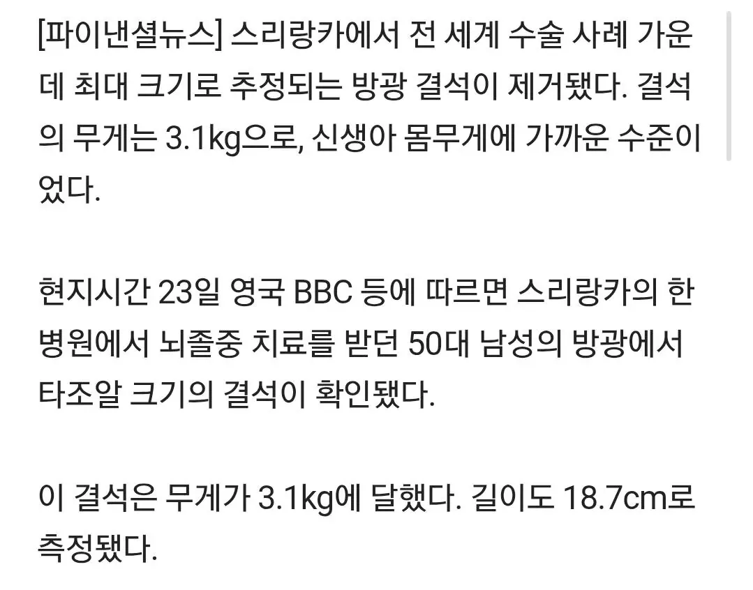 "10년간 방광서 커졌다"…타조알 크기 3.1kg 결석 제거