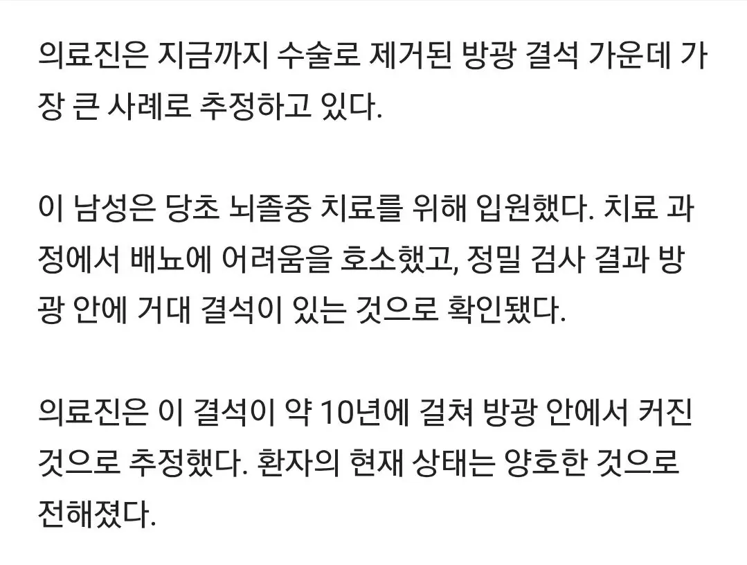 "10년간 방광서 커졌다"…타조알 크기 3.1kg 결석 제거