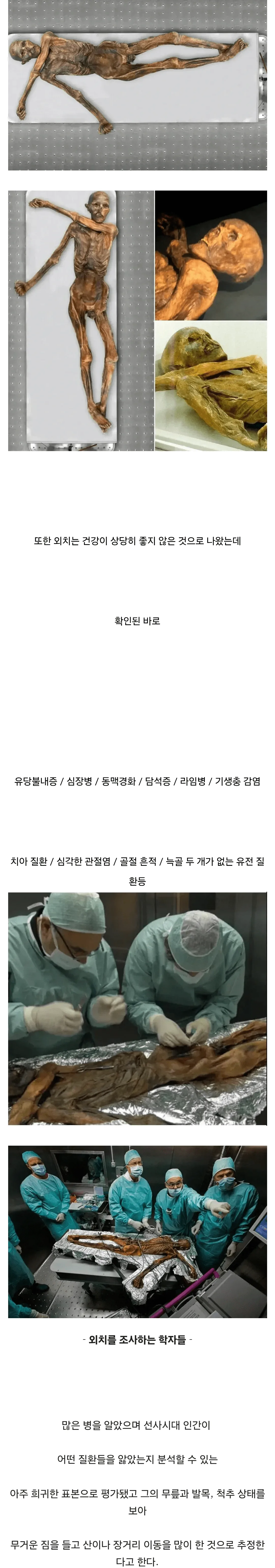 혐?)얼음 속에서 5000년 넘게 잠들어 있던 미라 이야기