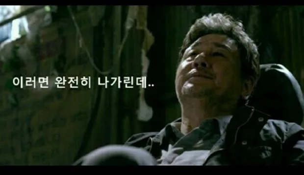 못 생긴 남자의 눈 수술 후기