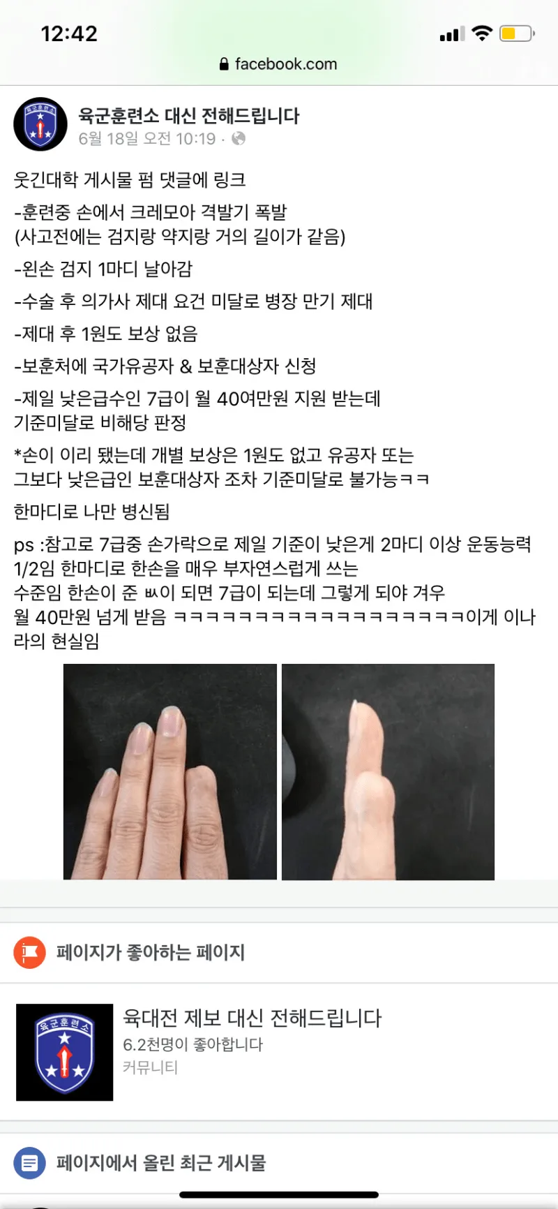 훈련중 크레모아 격발기 피해 후기.jpg