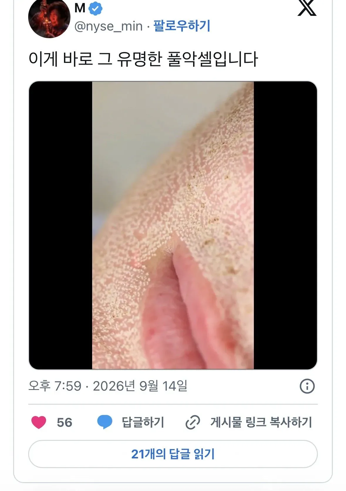 IMG_1233.jpeg 피부관리중 효과 좋다지만 못하는 사람은 절대 못하는 것.JPG