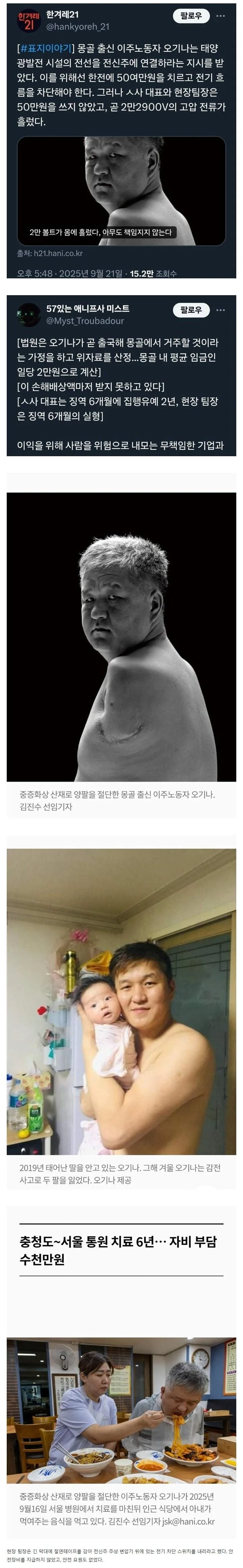 50만원 때문에 양팔을 잃은 외국인 노동자.jpg