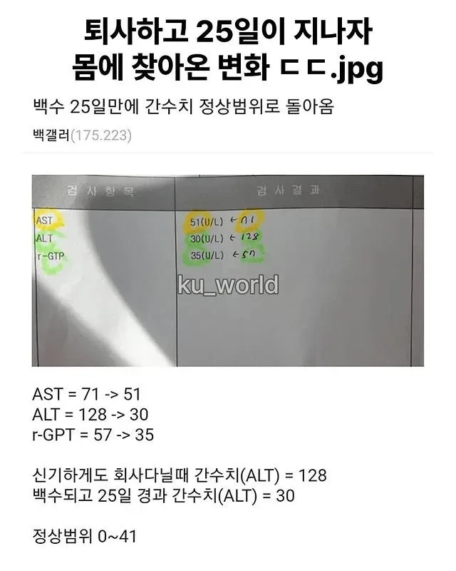 퇴사하고 25일 만에 몸에 찾아온 변화.jpg
