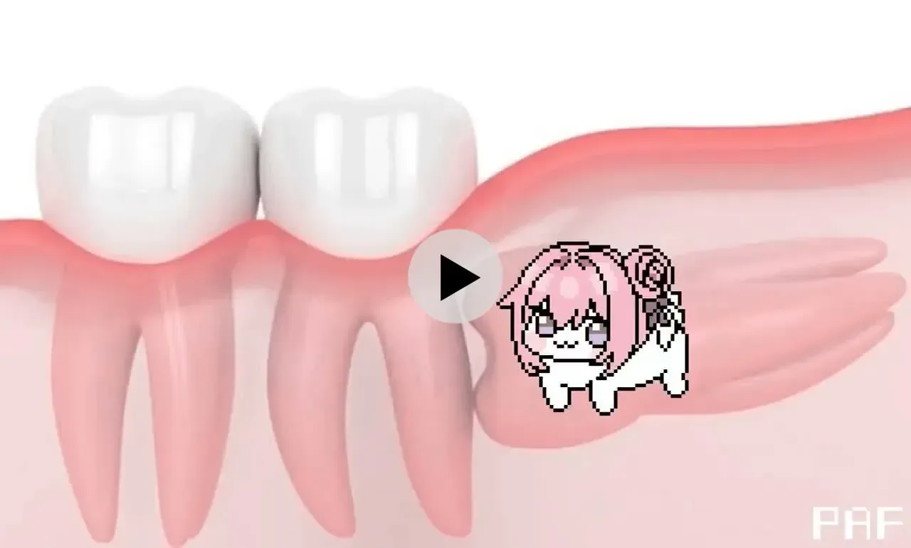 도로롱으로 보는 사랑니