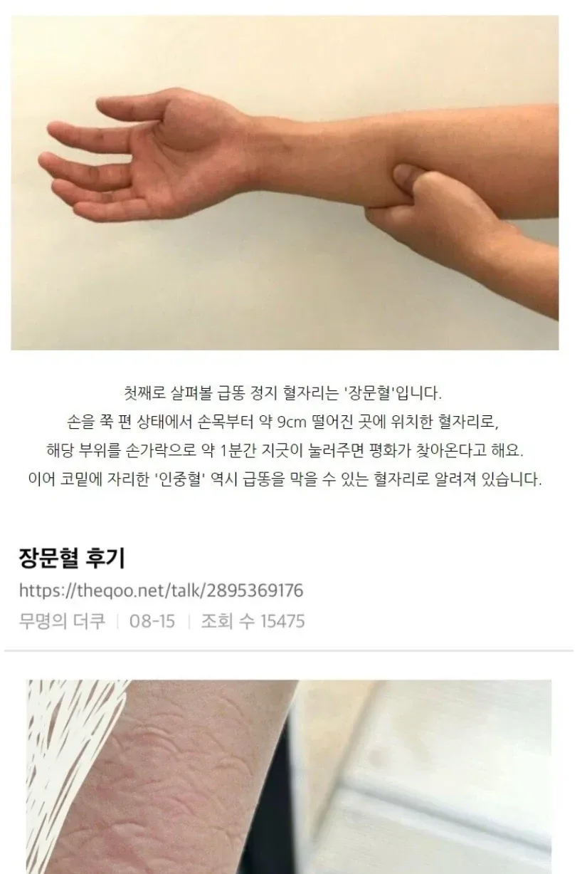 장문혈 후기.jpg