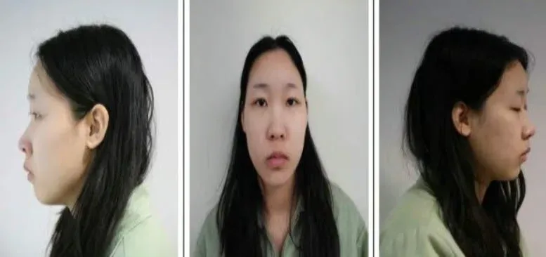 [속보] '강북 모텔 연쇄살인' 김소영, 1심서 무기징역