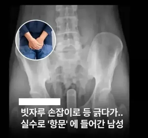 이게 가능한 일이냐고???