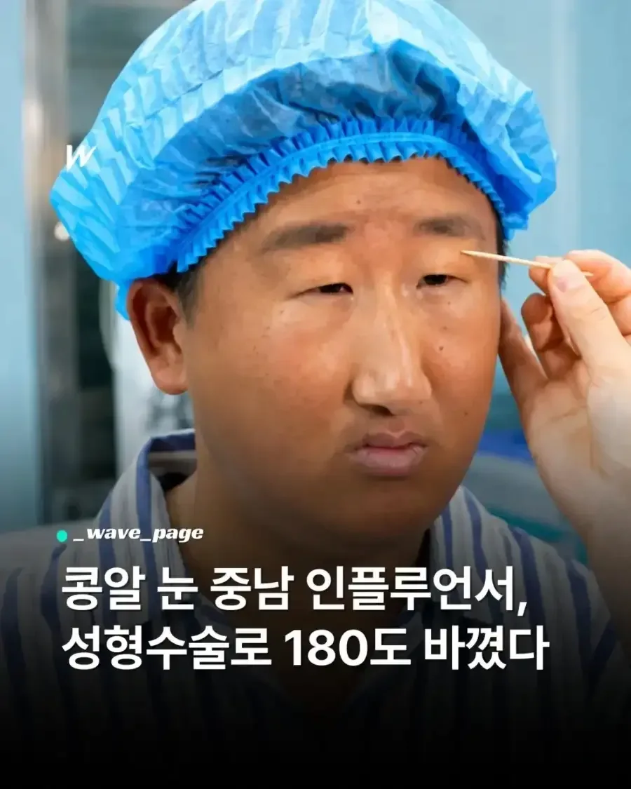 못 생긴 남자의 눈 수술 후기