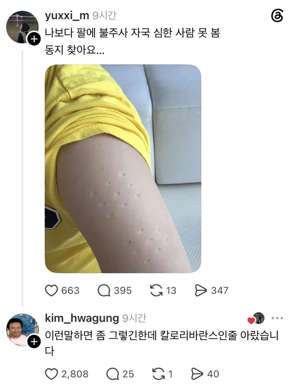 나보다 불주사 자국 심한사람 못봄.jpg