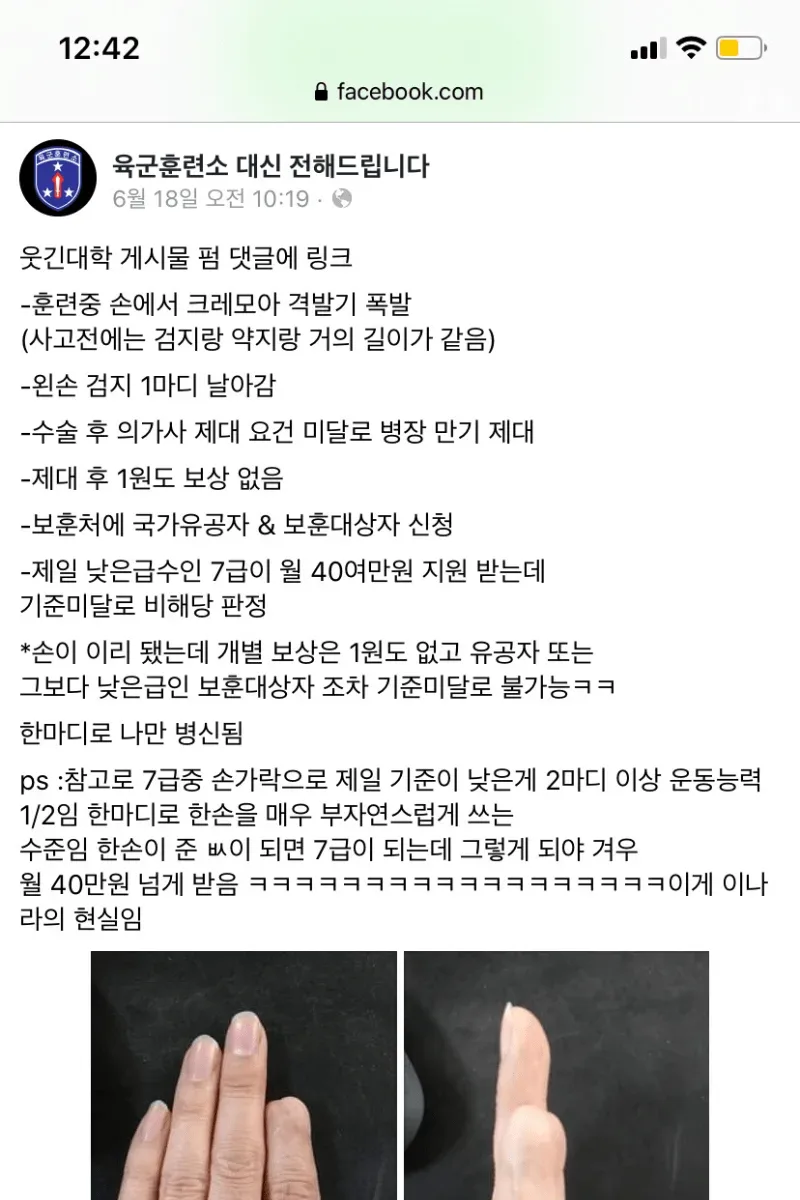 훈련중 크레모아 격발기 피해 후기.jpg