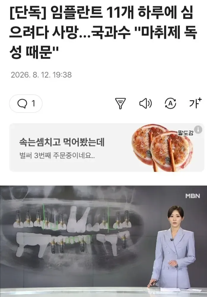 임플란트 11개 하루에 심으려다 사망.jpg
