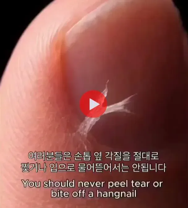 손톱 옆에 생긴 거스러미를 뜯으면 생기는 일.mp4
